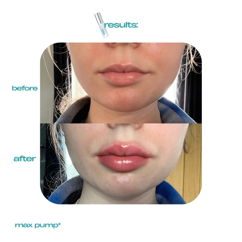 Long Lasting Lip Plumper