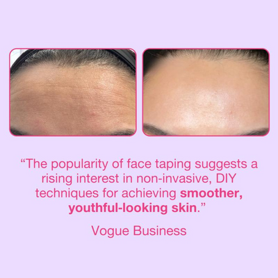 Glowze Anti Wrinkle Patches