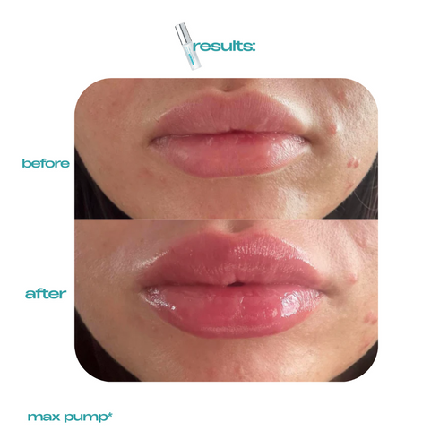 Long Lasting Lip Plumper