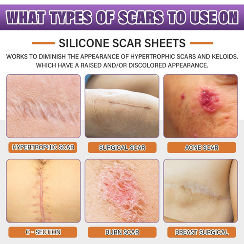 Glowze Renew Scar Tape