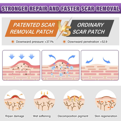 Glowze Renew Scar Tape