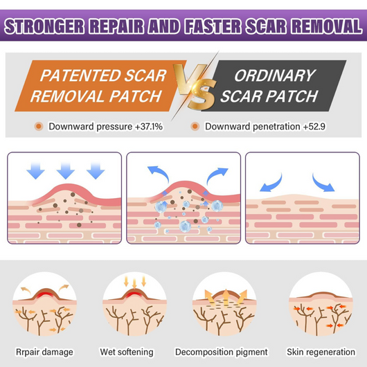 Glowze Renew Scar Tape