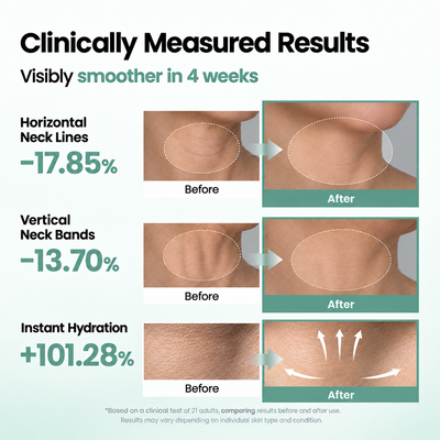 Clinically measured results — smoother neck in 4 weeks